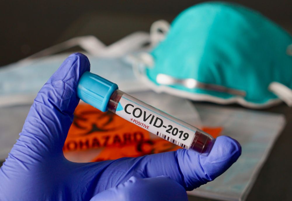 Bilanț coronavirus 22 august: 1.189 de cazuri noi, 37 decese și 504 persoane internate la ATI