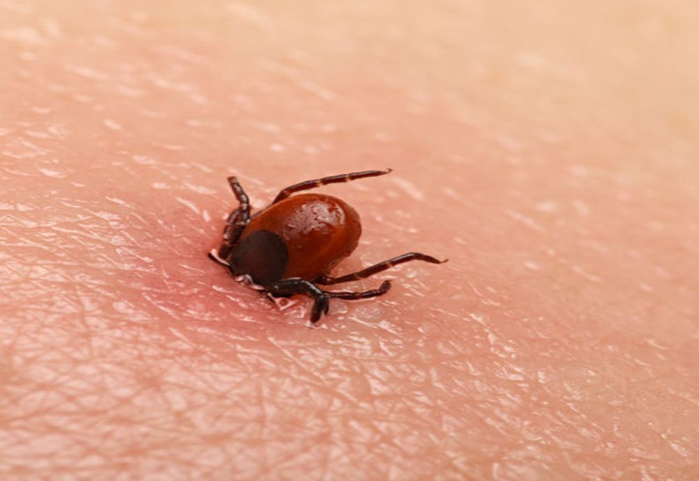 Boala Lyme și ce pericole are mușcătura de căpușă