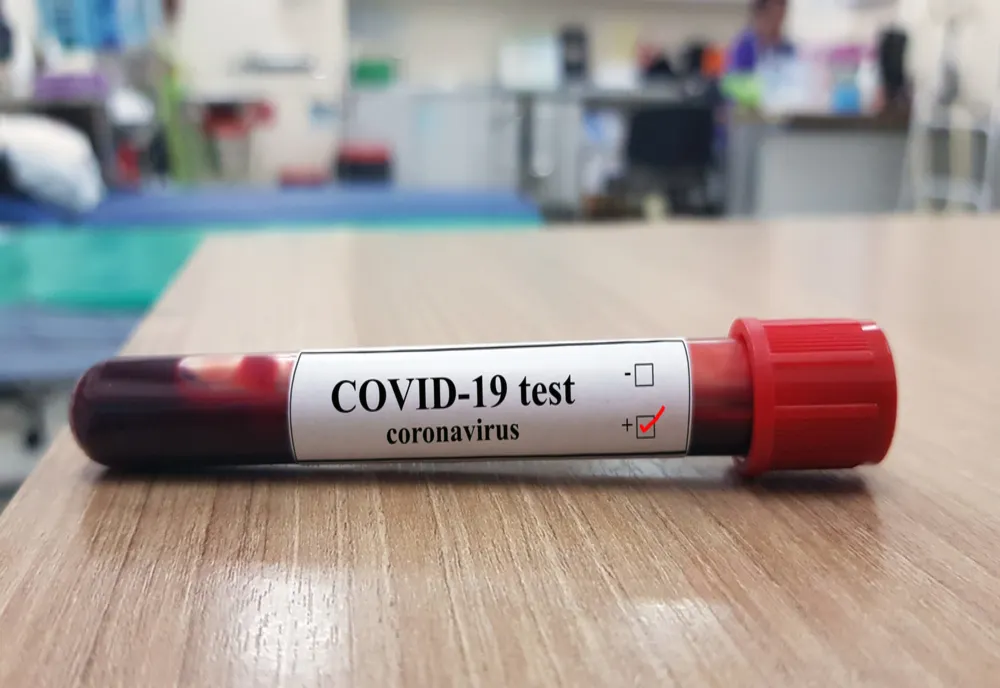 În acest moment, DSP Călărași deține materiale pentru recoltarea probelor de COVID-19 pentru un număr de 570 de probe