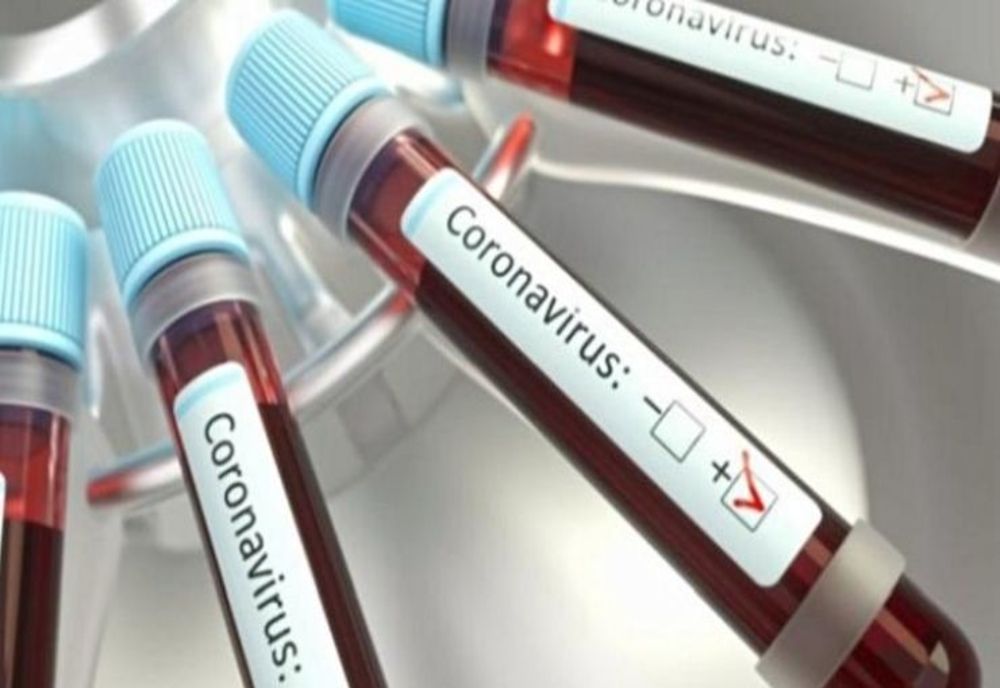 Bilanț coronavirus 17 septembrie: 1.679 de cazuri noi, 27 de decese și 460 persoane internate la ATI