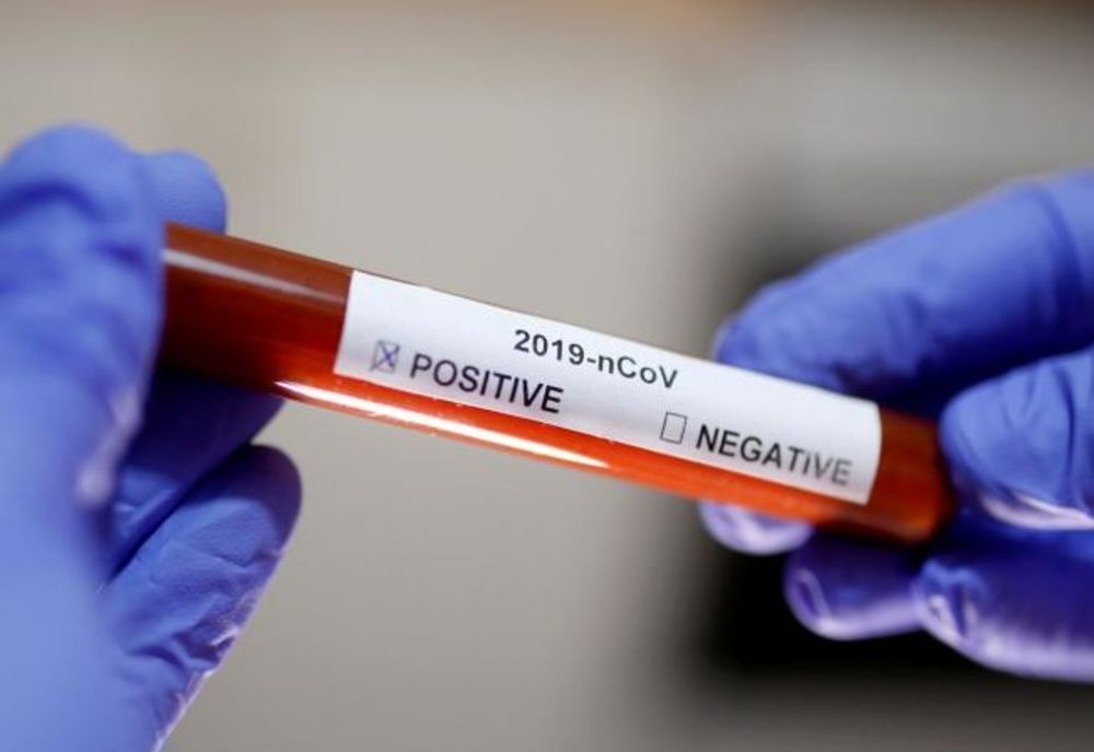 Bilanț coronavirus 14 ianuarie: 9.884 cazuri noi și 30 decese