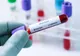 Bilanț coronavirus 06 decembrie 2021: 803 cazuri noi și 54 decese