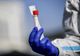 Bilanț coronavirus 19 august. Noile cifre anunțate oficial: 1.409 cazuri noi, 32 de decese