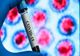 Bilanț coronavirus 5 decembrie: 916 cazuri noi și 78 de decese dintre care 5 anterioare