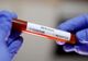  Bilanț coronavirus 31 ianuarie: 20.131 cazuri noi și 41 decese