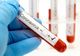 Bilanț coronavirus 10 ianuarie: 4.104 cazuri noi și 16 decese